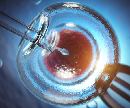 IVF Treatment